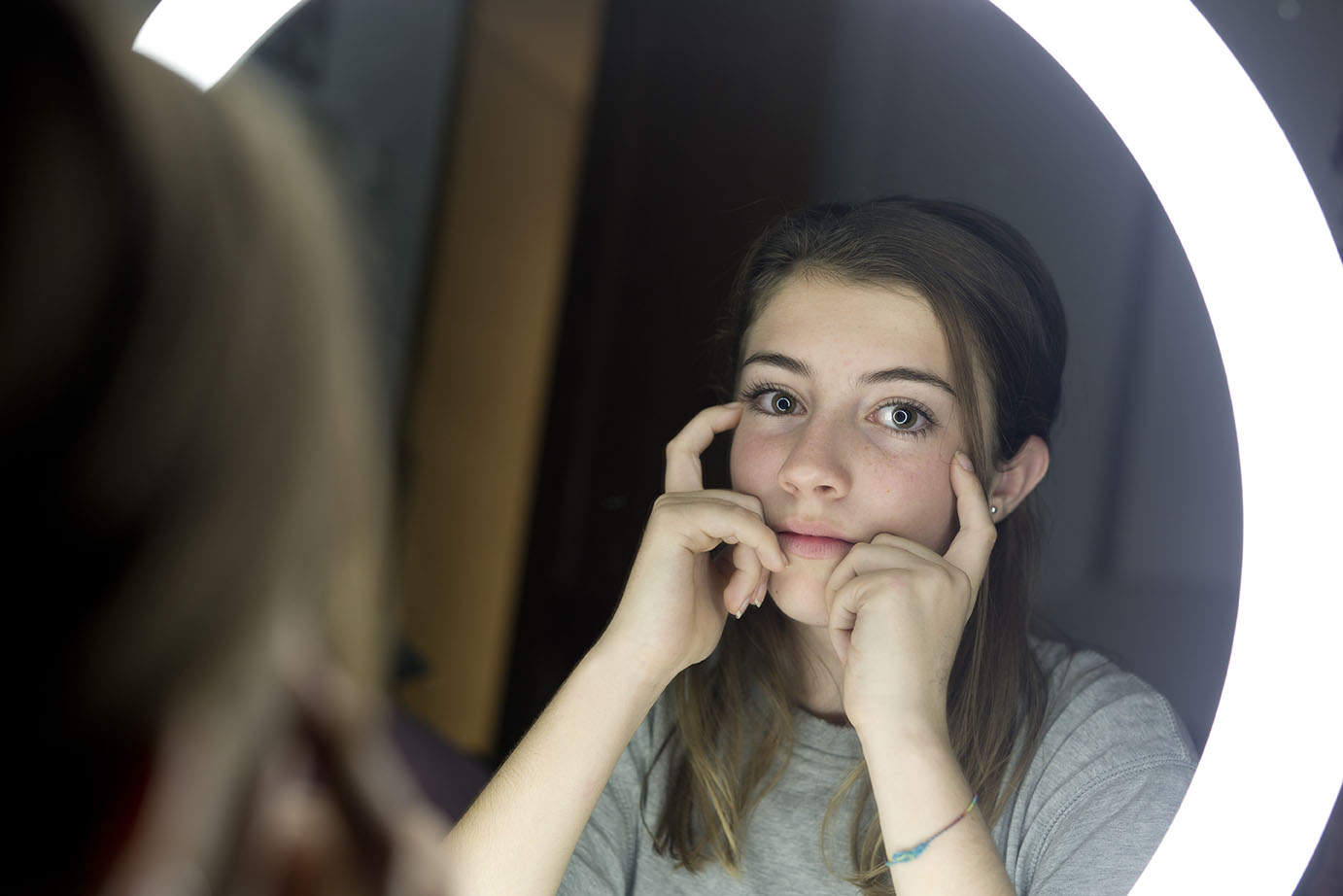 body-dysmorphic-disorder-acamh